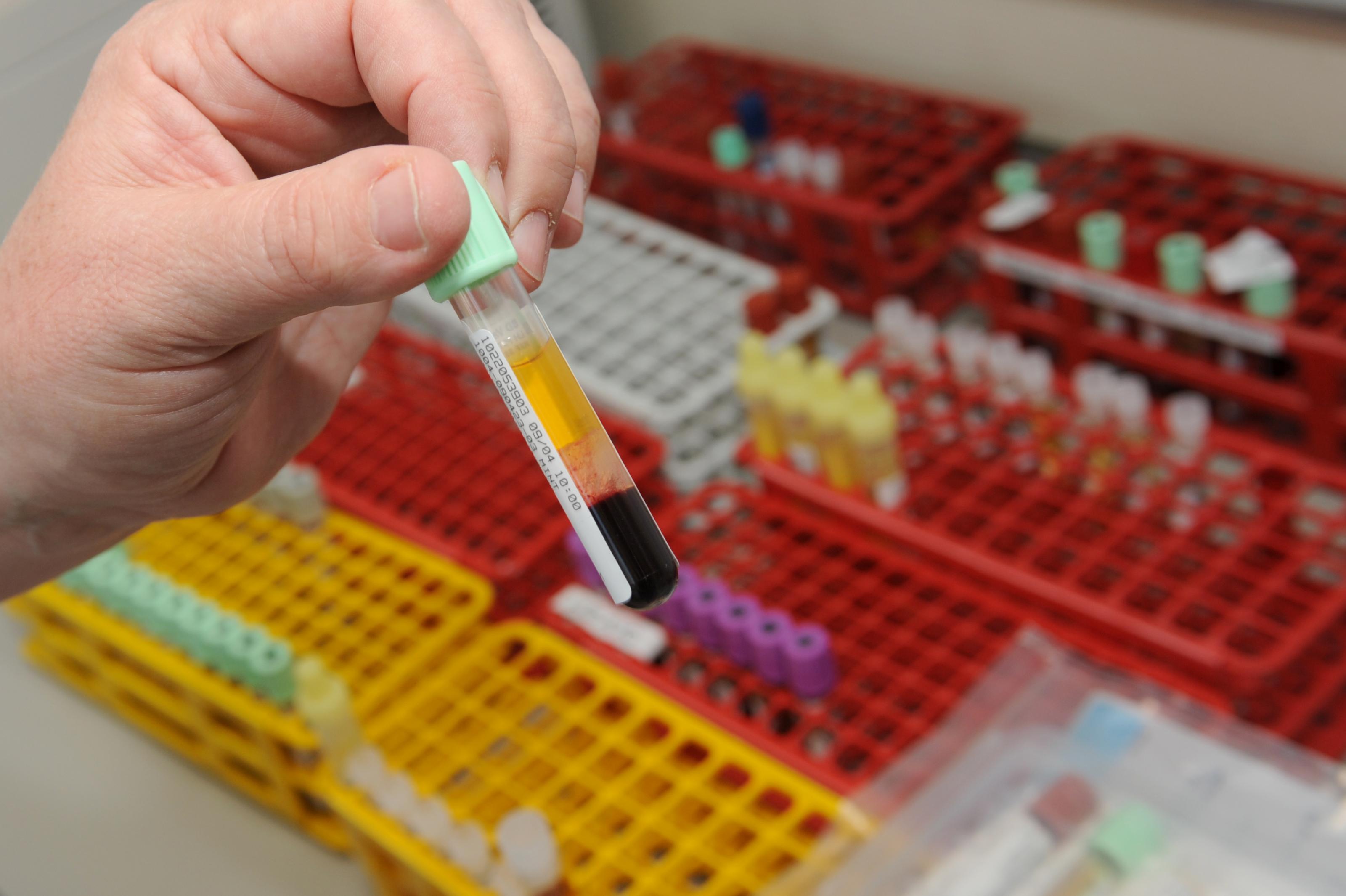 Bloedafname en onderzoek | Dijklander Ziekenhuis